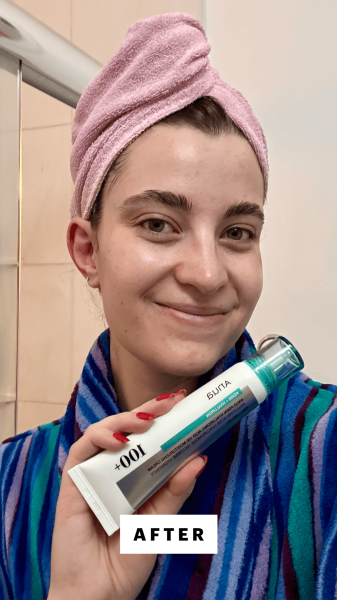 Felbin after applying the Anua PDRN Hyaluronic Acid 100 Moisturizing Cream